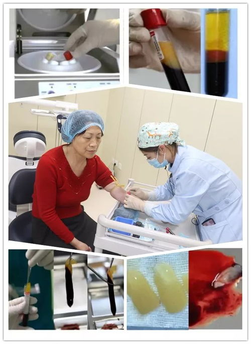 就在本周六,有30年经验的北京协和医院口腔科专家林润台教授亲诊号,必须抢一个